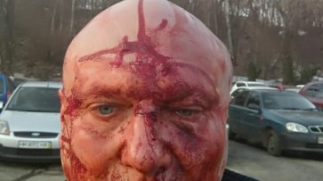В Киеве проломили голову догхантеру. 18+