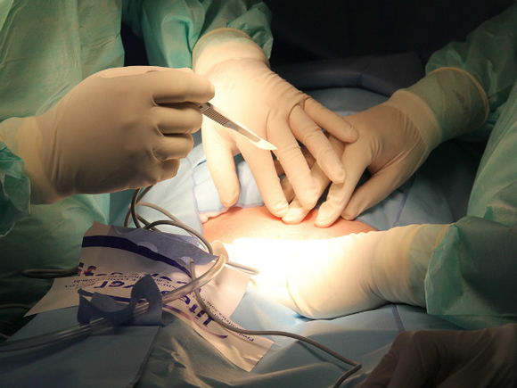 В больнице РЖД женщине по ошибке удалили грудь - «Новости дня»