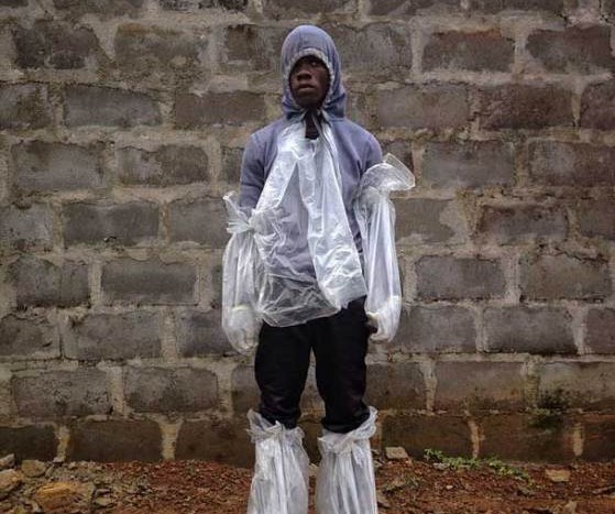 Жертвами вируса Эболы стали свыше 800 человек в Конго - «Новости Дня»