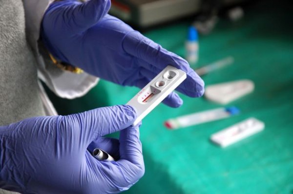 В Роспотребнадзоре заявили о снижении роста заболеваемости ВИЧ - «Происшествия»