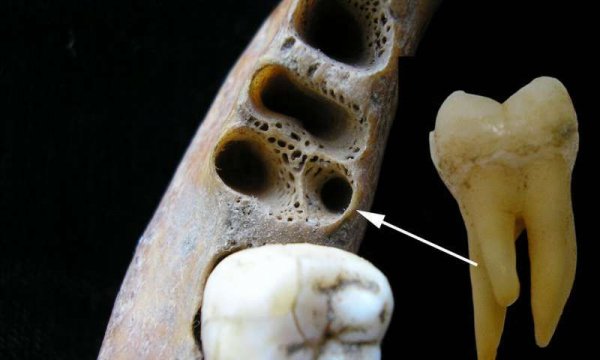 Нижние коренные зубы с тремя корнями достались жителям Азии от денисовцев - «Общество»