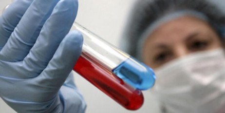 Ученые приблизились к созданию вакцины от ВИЧ - «Общество»