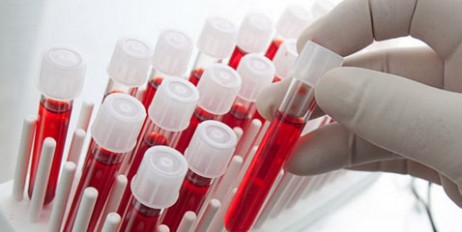 Ученые выяснили, носители какой группы крови уязвимы к онкологии - «Общество»