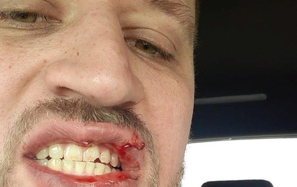 Ветеран АТО заявил, что его избили в Киеве