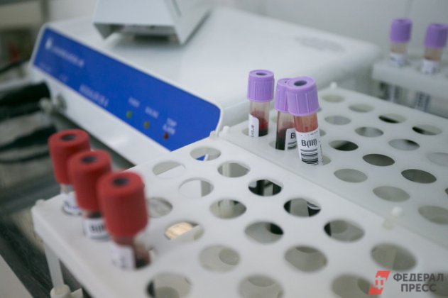 В Свердловской области число новых случаев ВИЧ-инфекции снизилось на 17%